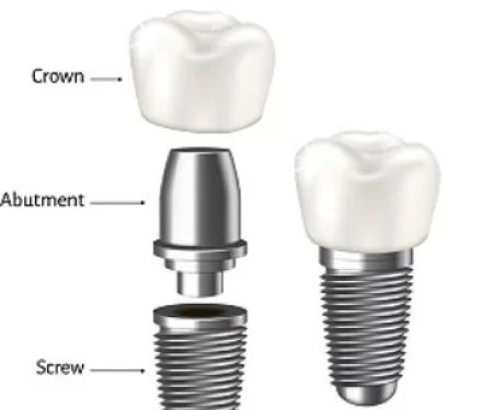 uba85uce58uacfc IMPLANT Dental office