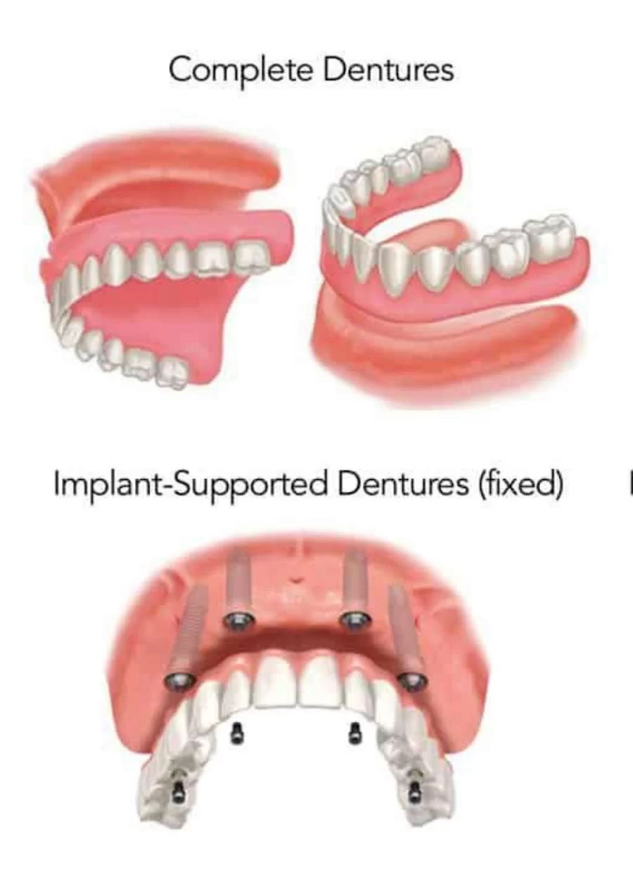 명치과 IMPLANT Dental office Picture 9