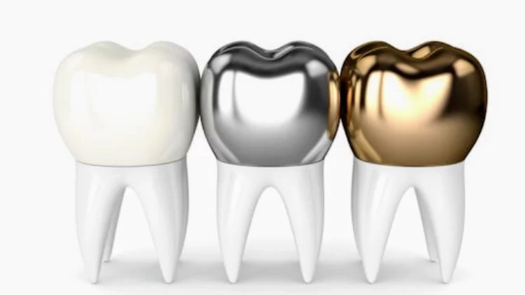 명치과 IMPLANT Dental office Picture 8