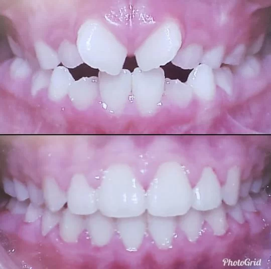Fernandes Orthodontics | Tony Fernandes DDS | Modern Orthodontist in Los Angeles Picture 4