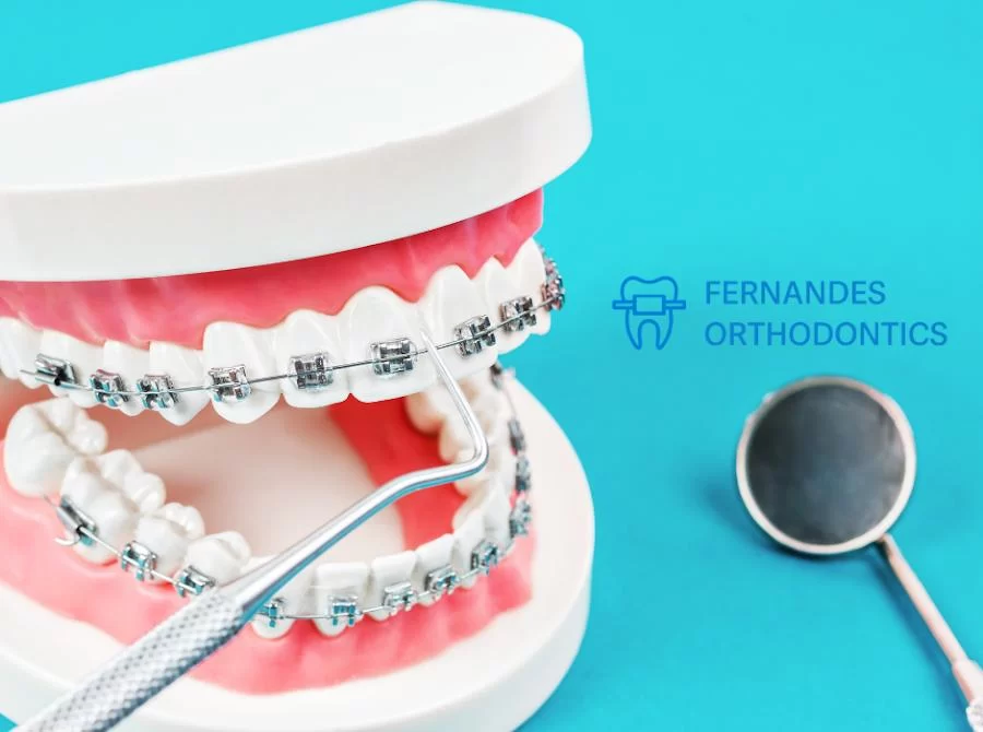 Fernandes Orthodontics | Tony Fernandes DDS | Modern Orthodontist in Los Angeles Picture 6
