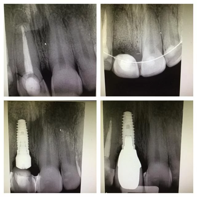 RNA Dentistry: Rozita Nosratabadi, DDS Picture 8