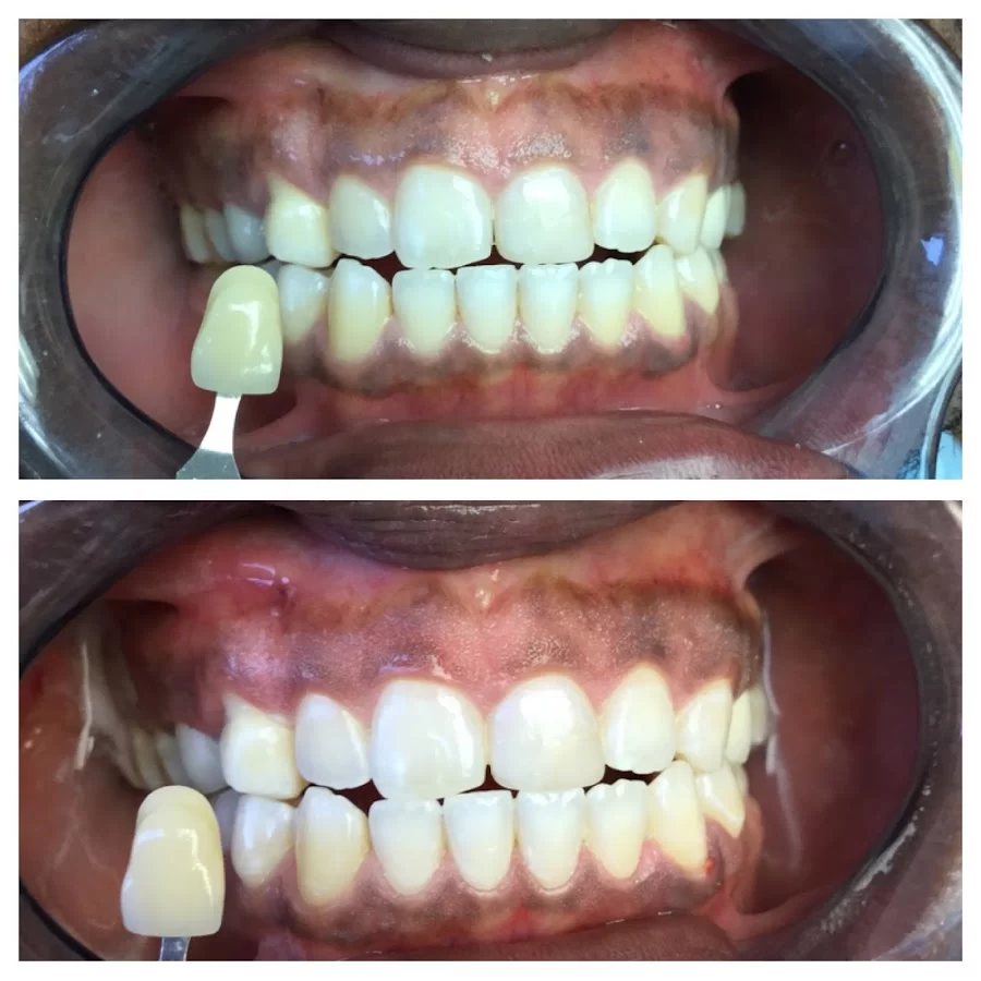 RNA Dentistry: Rozita Nosratabadi, DDS Picture 7