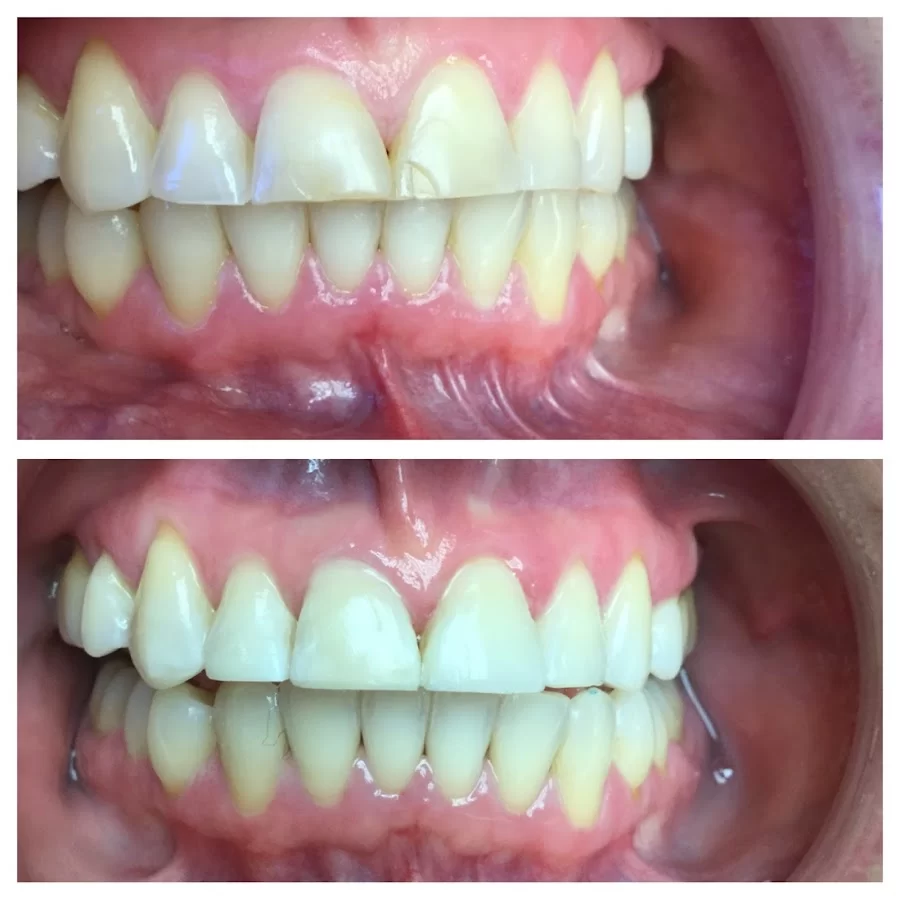 RNA Dentistry: Rozita Nosratabadi, DDS Picture 5
