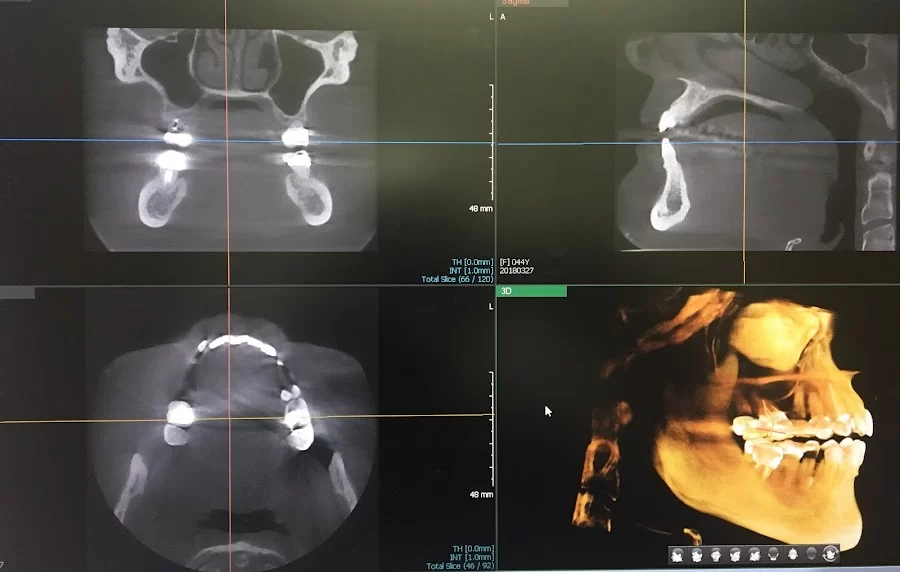 RNA Dentistry: Rozita Nosratabadi, DDS Picture 4