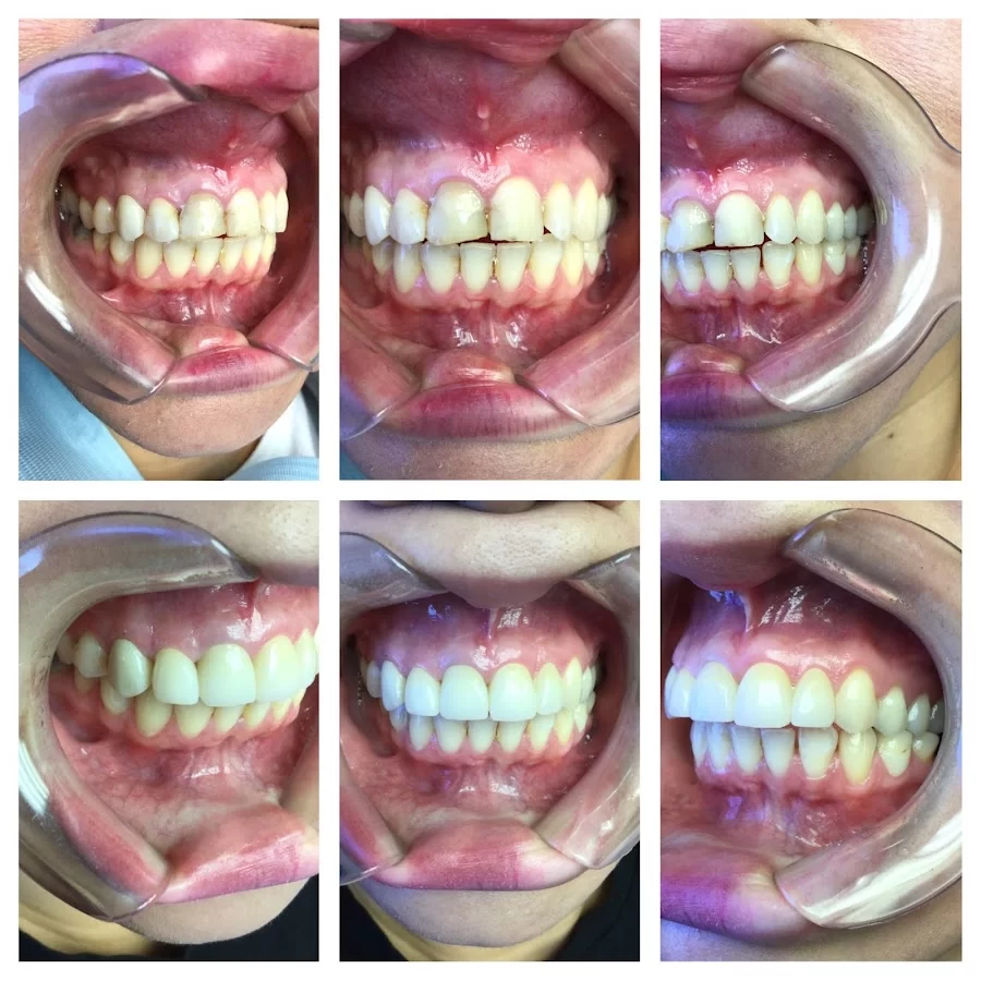 RNA Dentistry: Rozita Nosratabadi, DDS Picture 6