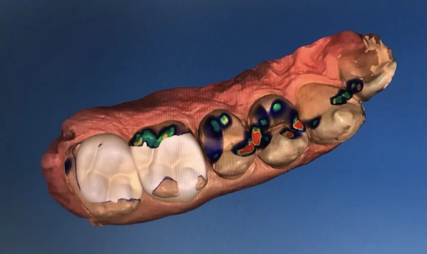Los Angeles Dental Arts - Westchester Picture 3