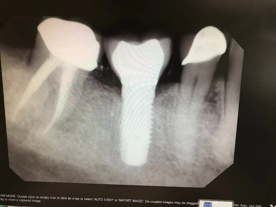 All In One Dental Picture 10