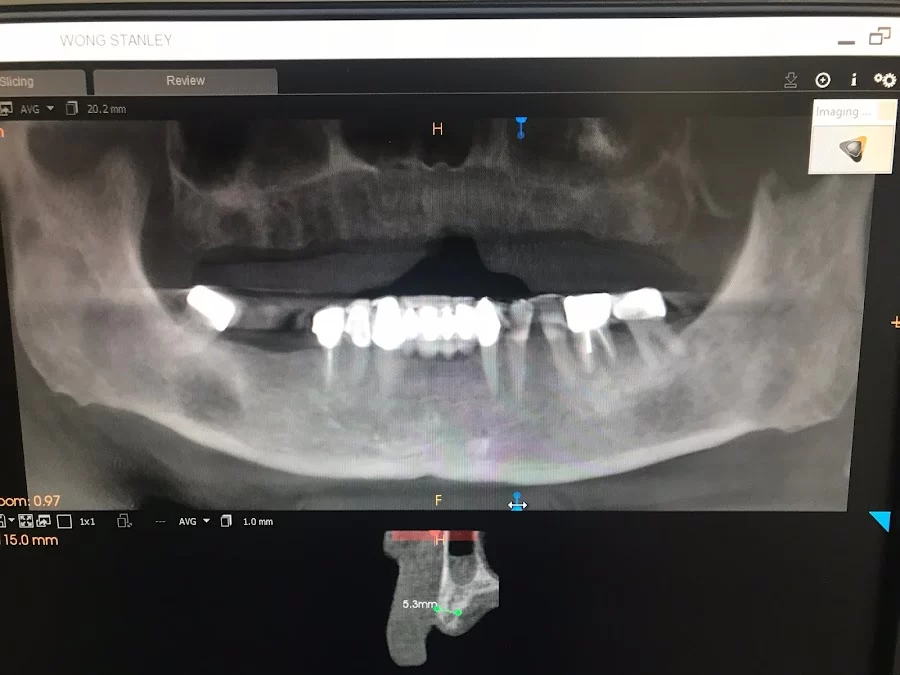 All In One Dental Picture 9