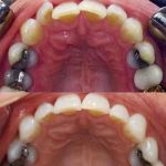Dental Solutions