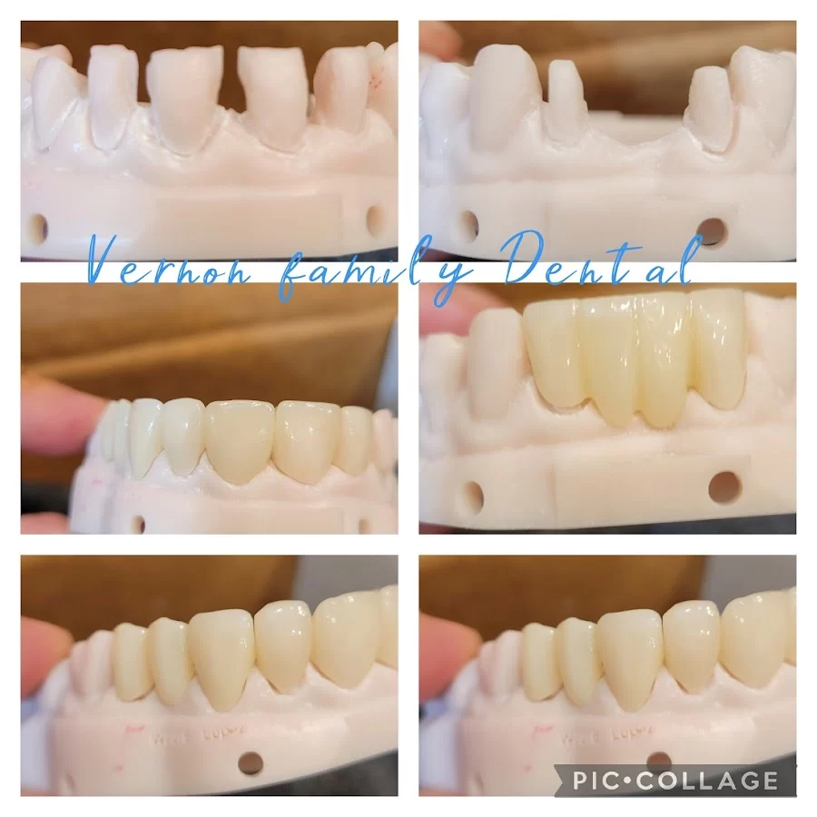 Vernon Family Dental Picture 2