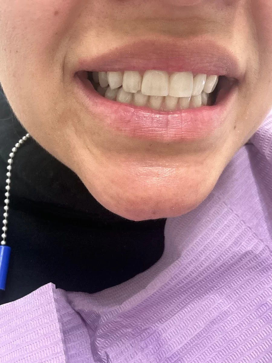 Hoover Dental Center Picture 4