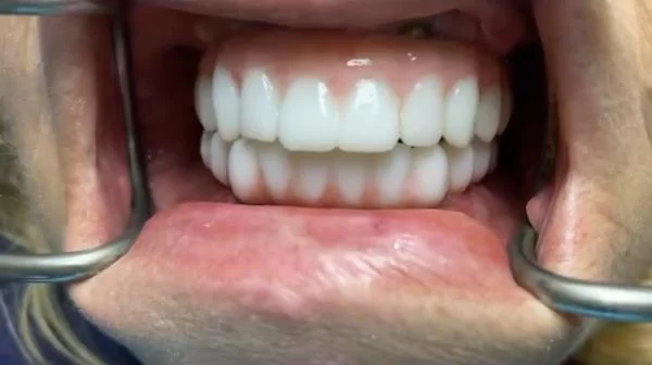 Orlando Lifestyle Dentistry Picture 3