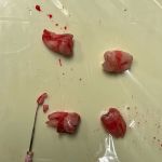 LAX DENTAL and ORTHODONTICS