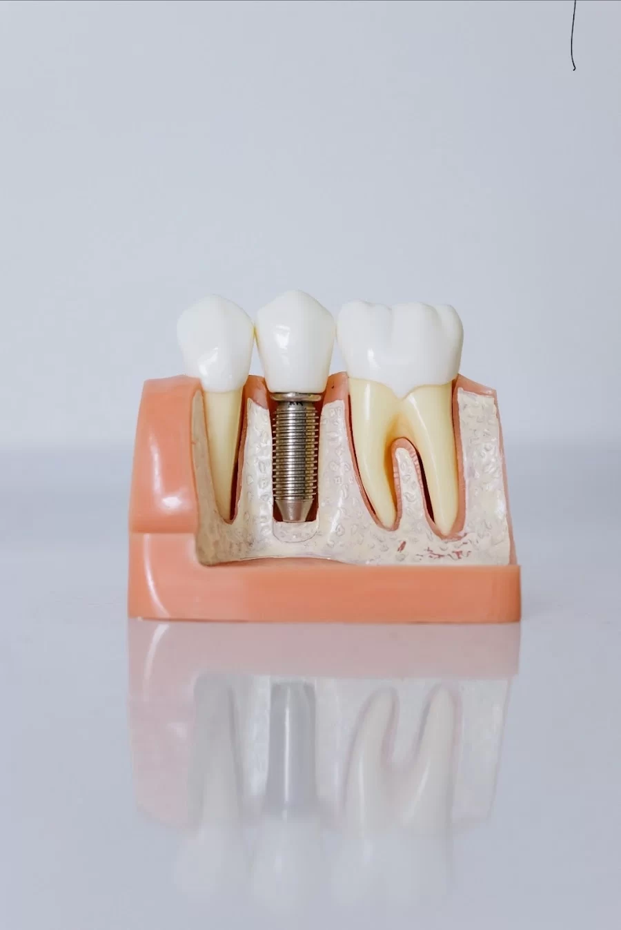Cal Dental of Van Nuys Picture 2
