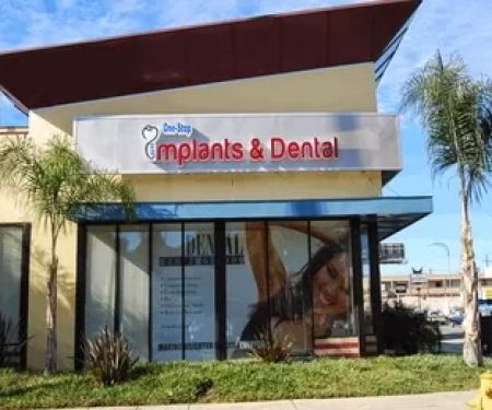 One Stop Implants