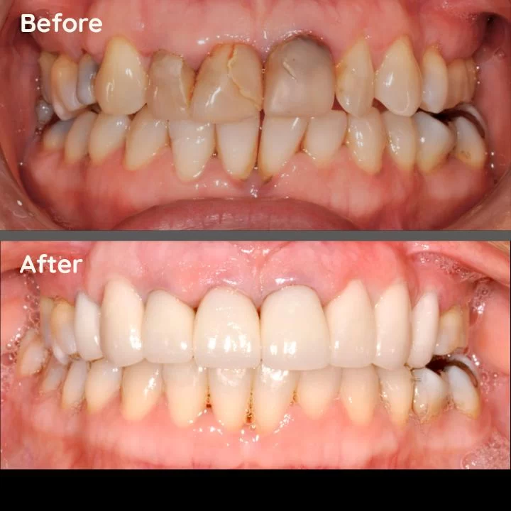 Whittier Dental Arts Picture 9