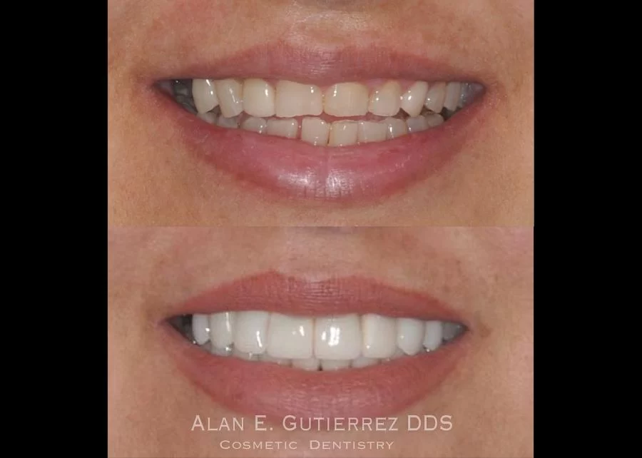 Whittier Dental Arts Picture 8