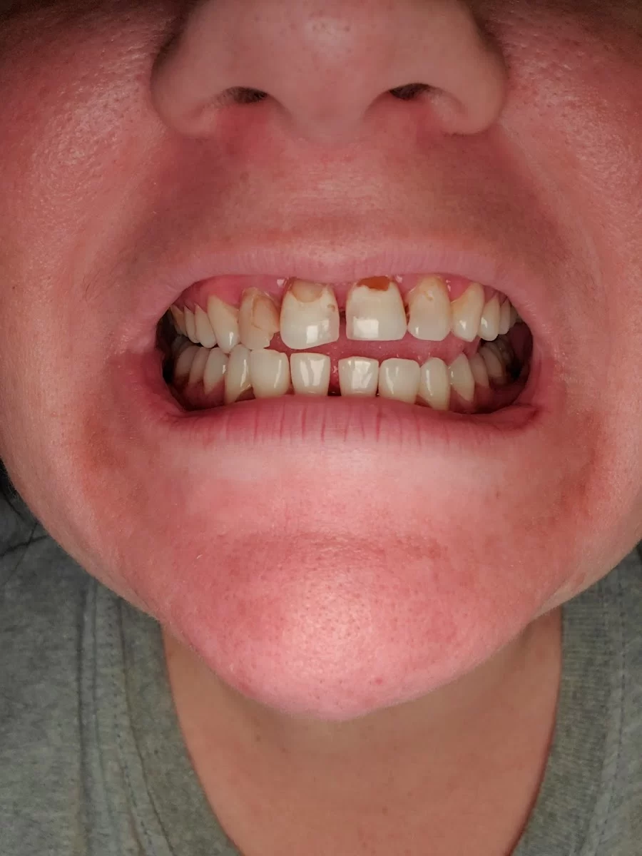 Nice Touch Dental Picture 6