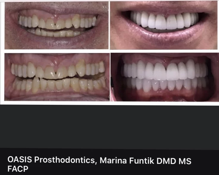 Oasis Prosthodontics, Marina Funtik, DMD, MS, FACP Picture 4