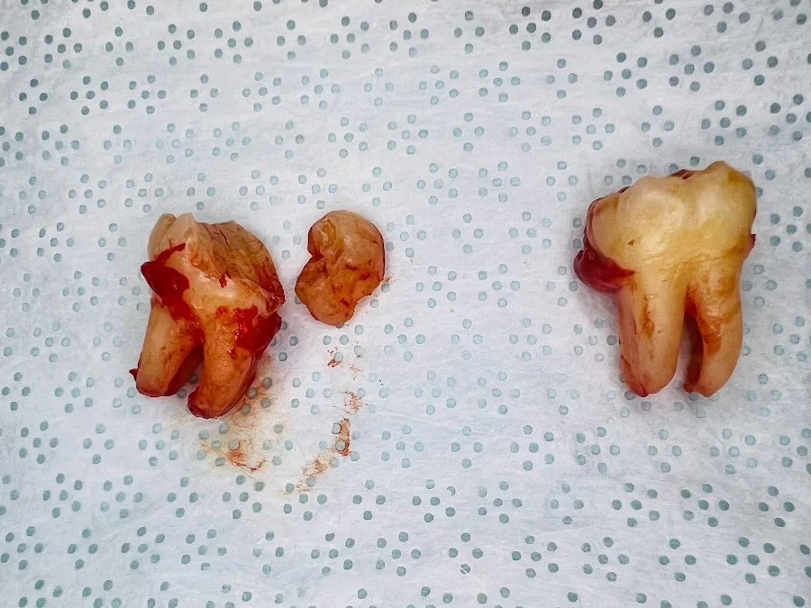 Downey Dental Solutions Picture 5