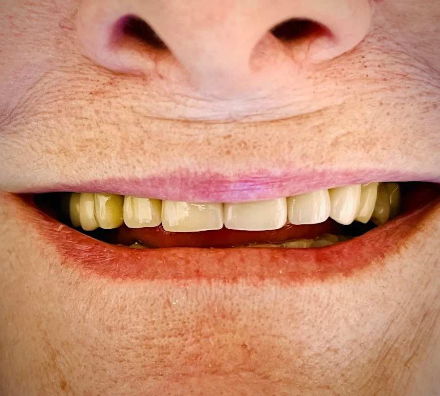 Downey Dental Solutions Picture 6