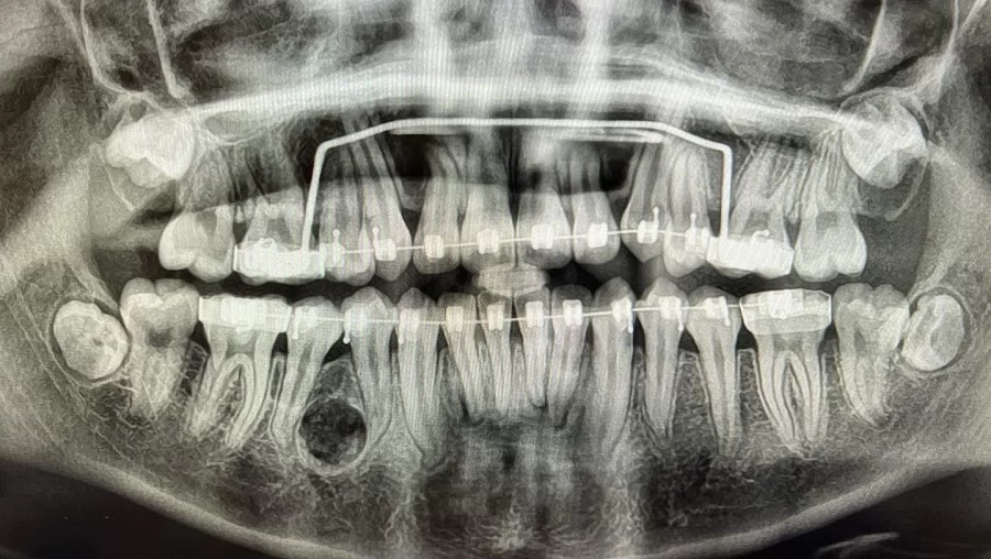 Downey Dental Solutions Picture 3