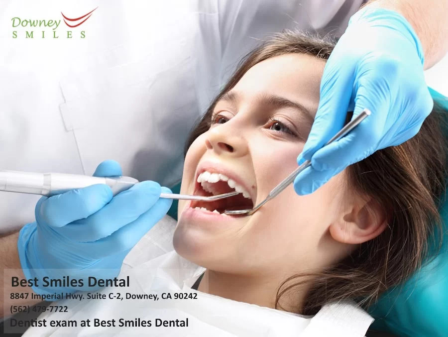 Downey Dentist by Best Smiles Dental Picture 10