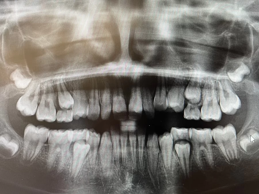 Smile Solutions Orthodontics Picture 5