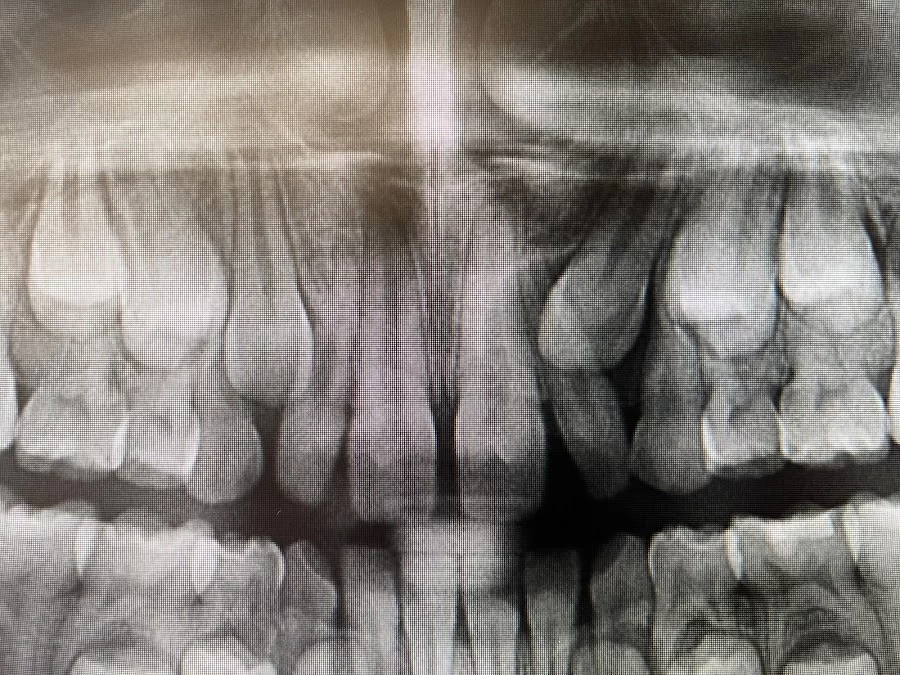 Smile Solutions Orthodontics Picture 8
