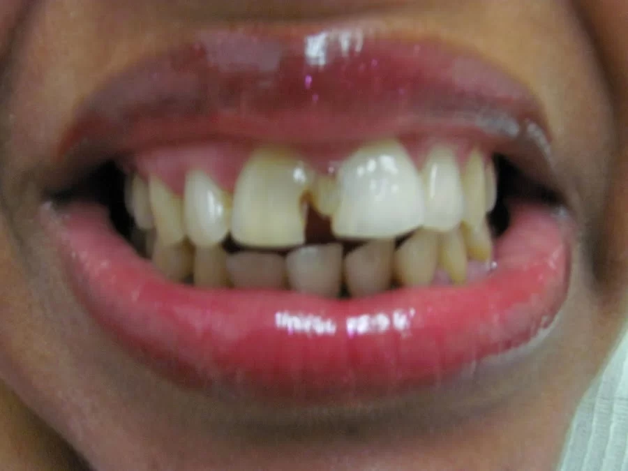 Brunswick Dental Associate-Dentista Hispana New Brunswick Picture 1