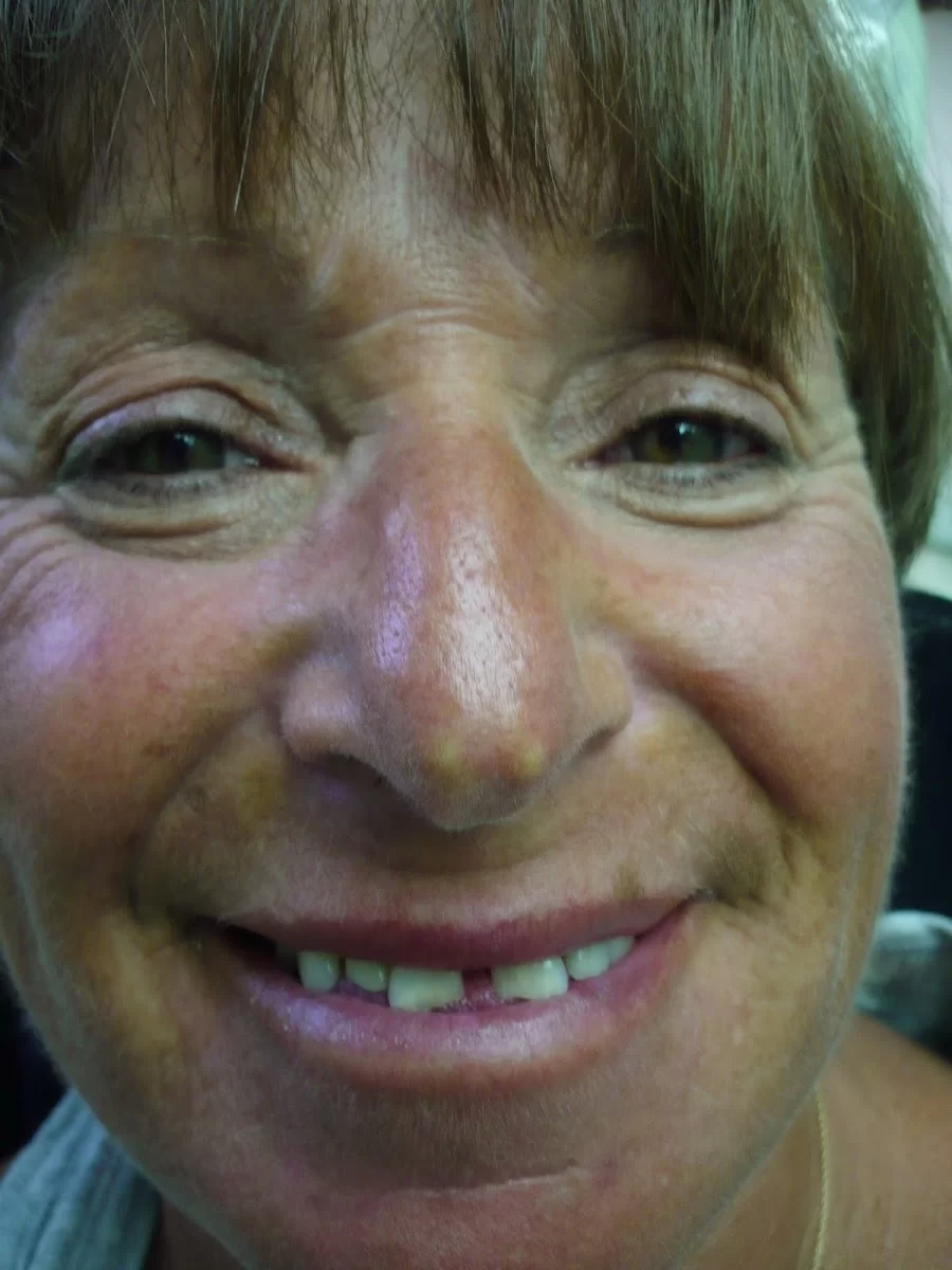 Brunswick Dental Associate-Dentista Hispana New Brunswick Picture 7