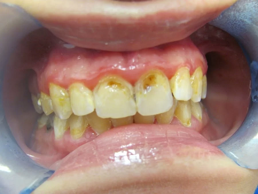 Brunswick Dental Associate-Dentista Hispana New Brunswick Picture 3