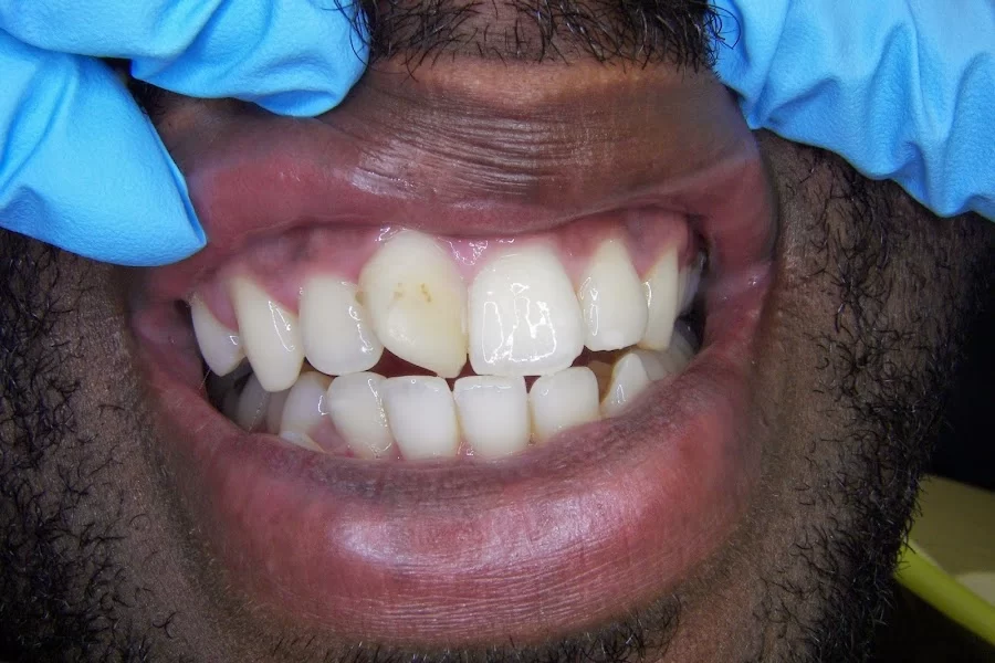Brunswick Dental Associate-Dentista Hispana New Brunswick Picture 8