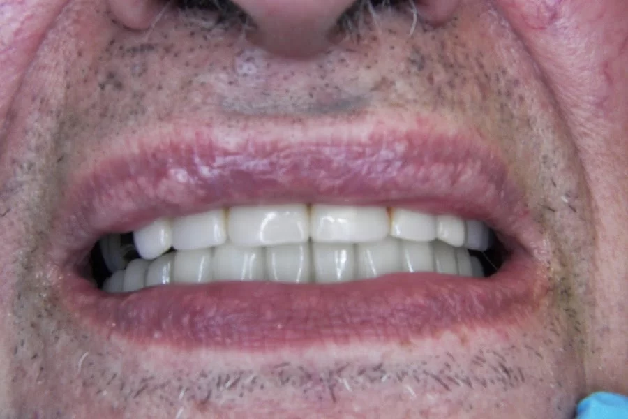 Brunswick Dental Associate-Dentista Hispana New Brunswick Picture 4