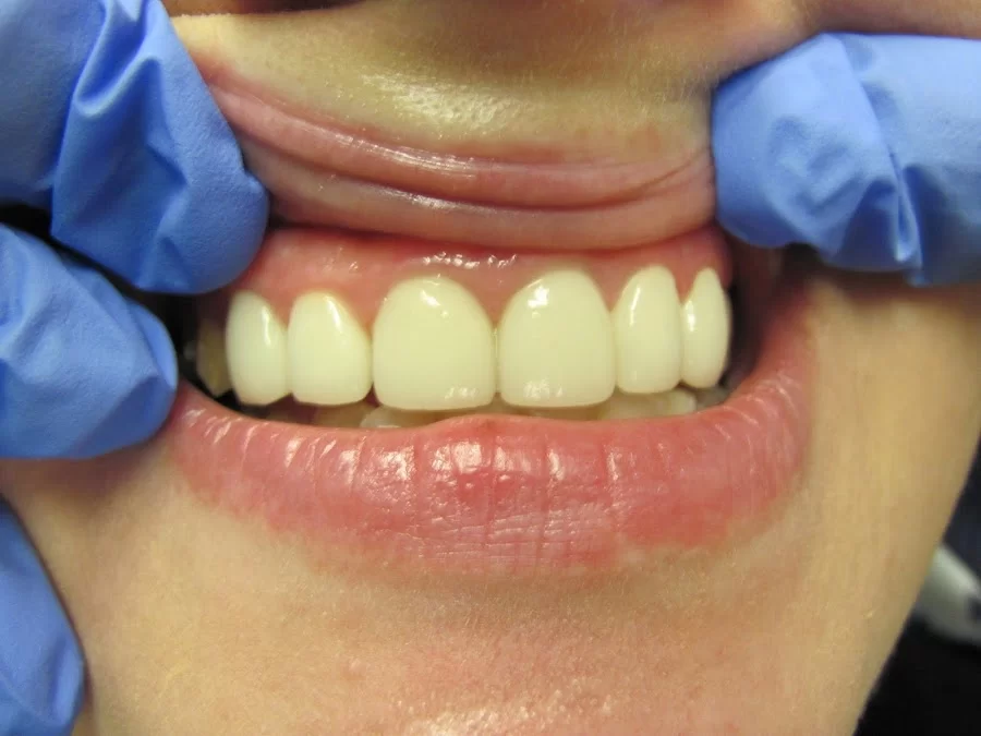 Brunswick Dental Associate-Dentista Hispana New Brunswick Picture 2