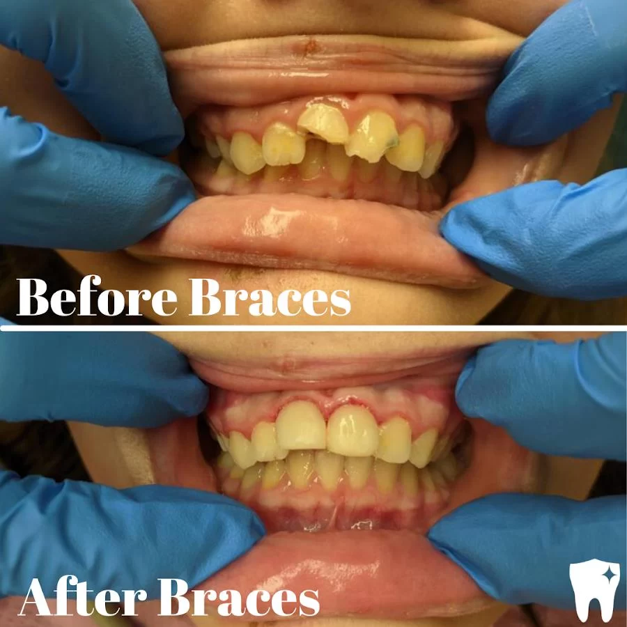 Lakewood Dentistry & Orthodontics Picture 8