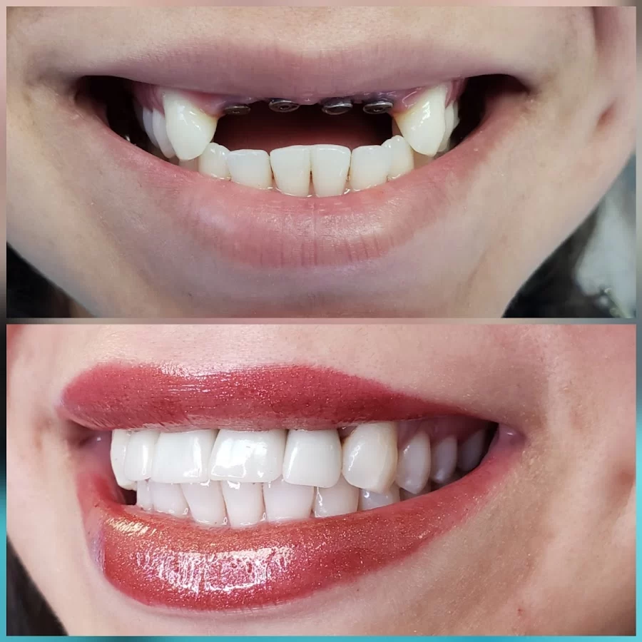 Acevedo Dental Group Montebello Picture 2