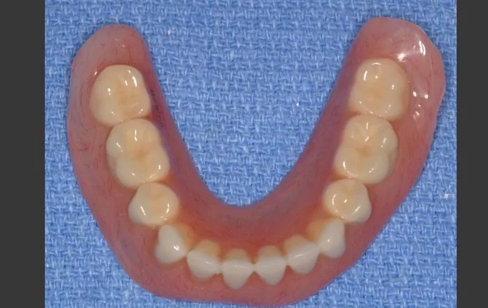 DentKits Picture 6