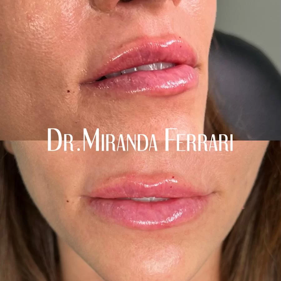 Ferrari Facial Aesthetics Picture 2