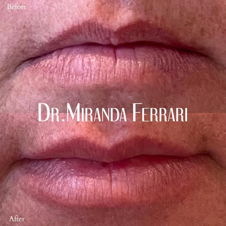 Ferrari Facial Aesthetics Picture 4