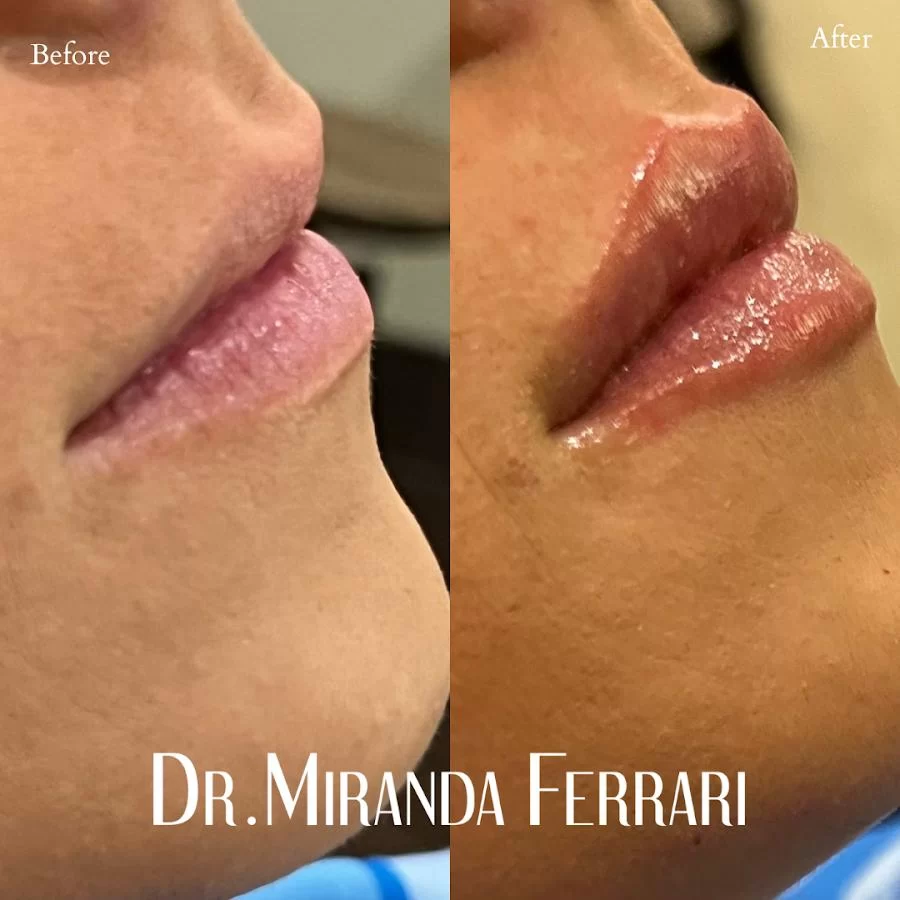 Ferrari Facial Aesthetics Picture 1