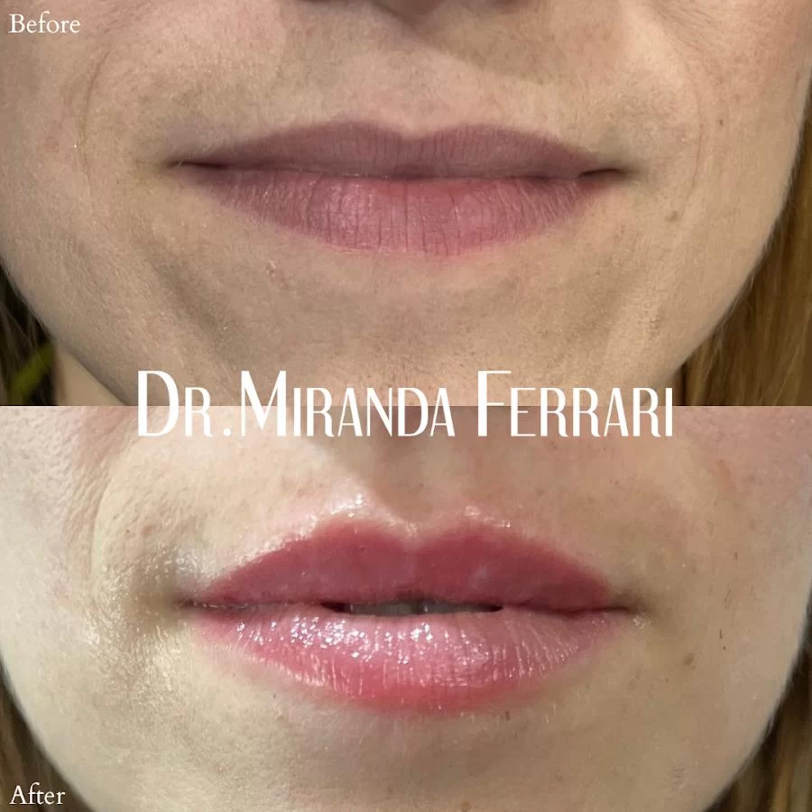 Ferrari Facial Aesthetics Picture 3