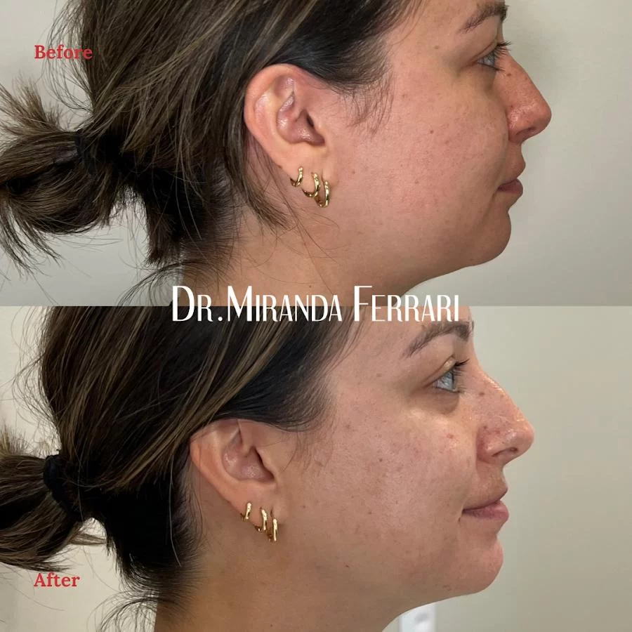 Ferrari Facial Aesthetics Picture 6