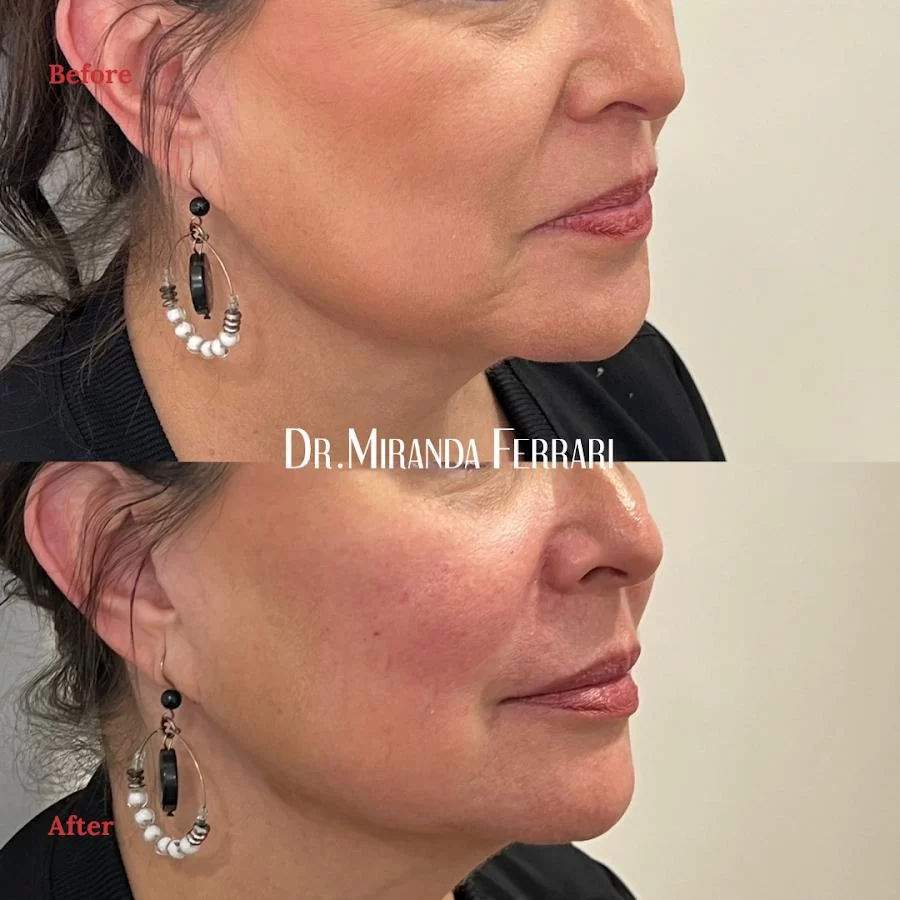 Ferrari Facial Aesthetics Picture 5