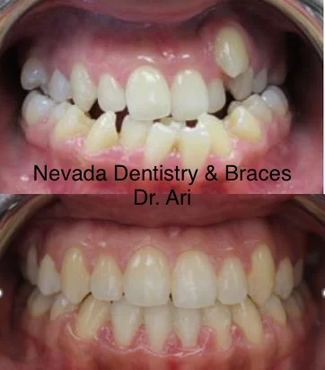 Nevada Dentistry & Braces Picture 2