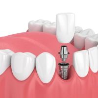 Nevada Dentistry & Braces ico
