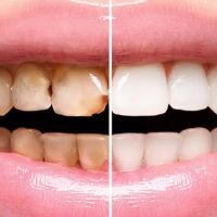 Reed Dental ico