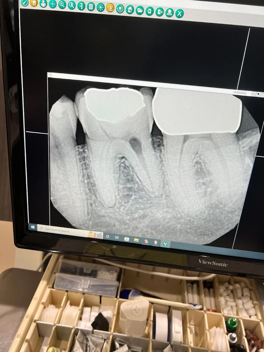 Sunset Endodontics Picture 2