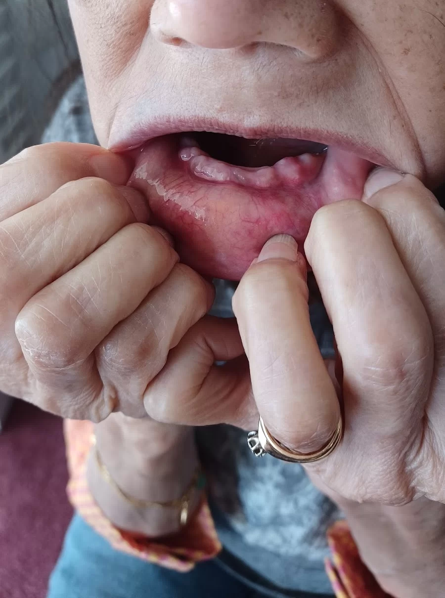 Affordable Dentures & Implants Picture 1